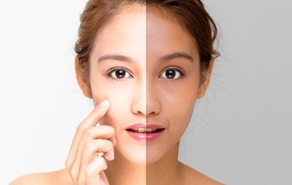 Explore All Options With Skin Whitening Solutions Now